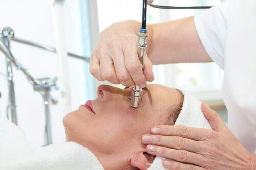 Microdermabrasion - 